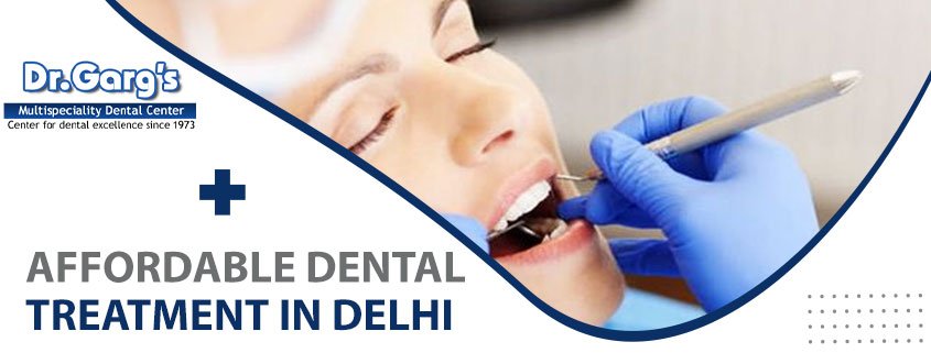 tooth implant cost in India