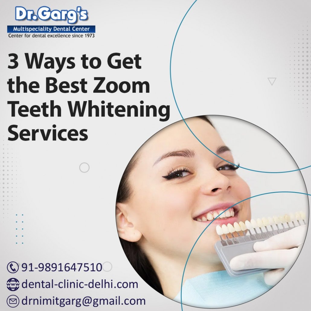 3 Ways to Get the Best Zoom Teeth Whitening Services teeth whitening 1030x1030 - 3 Ways to Get the Best Zoom Teeth Whitening Services