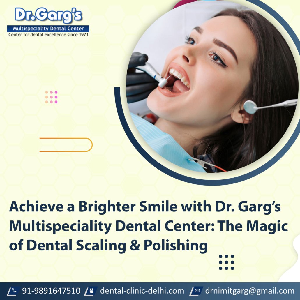 achieve a brighter smile with dr gargs multispeciality dental center 1030x1030 - Achieve a Brighter Smile with Dr. Garg’s Multispeciality Dental Center: The Magic of Dental Scaling and Polishing