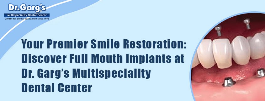 Your Premier Smile Restoration: Discover Full Mouth Implants at Dr. Garg’s Multispeciality Dental Center