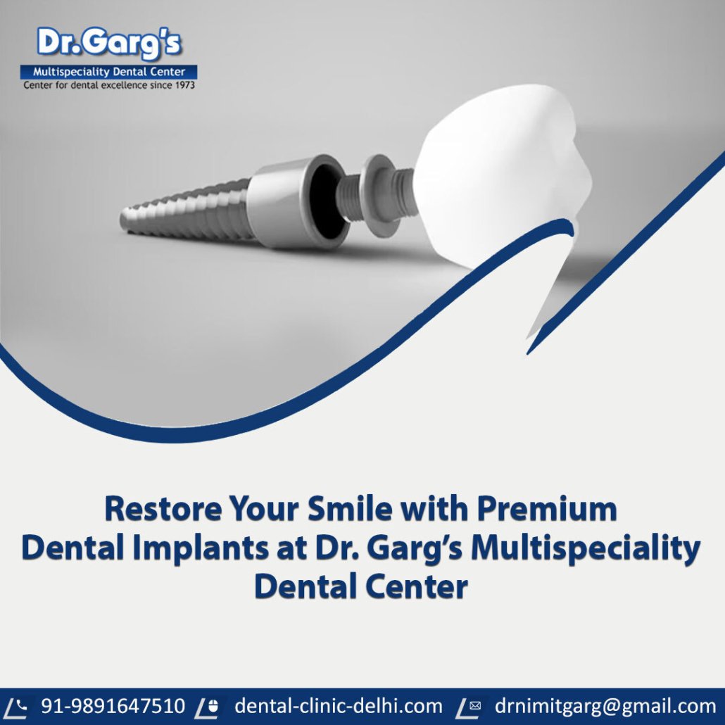 restore your smile with premium dental implants at dr 1030x1030 - Restore Your Smile with Premium Dental Implants at Dr. Garg’s Multispeciality Dental Center