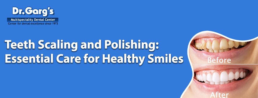ToothScalingAndPolishing