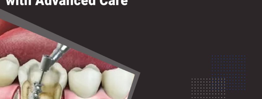 RCTofTeethPriceInIndia,