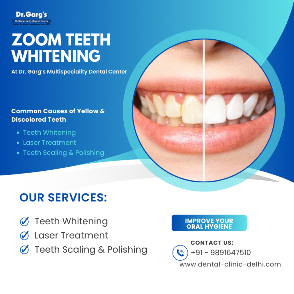 Zoom Teeth Whitening at Dr. Gargs Multispeciality Dental Center 1 1030x1030 - Zoom Teeth Whitening at Dr. Garg&rsquo;s Multispeciality Dental Center