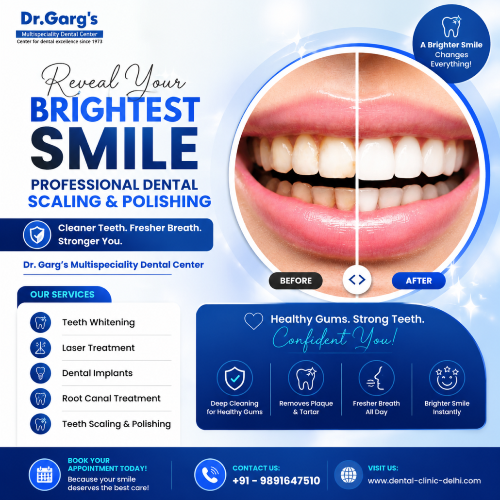 Teeth Scaling Procedure at Dr. Gargs Multispeciality Dental Center 1 1030x1030 - Teeth Scaling Procedure at Dr. Garg&rsquo;s Multispeciality Dental Center