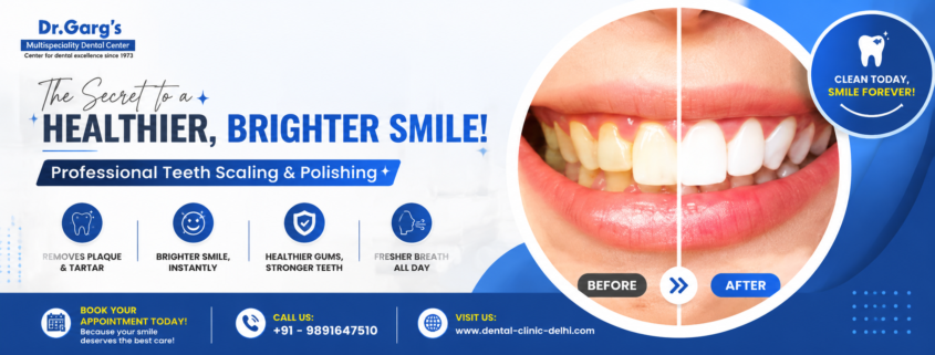 Before And After Scaling Teeth