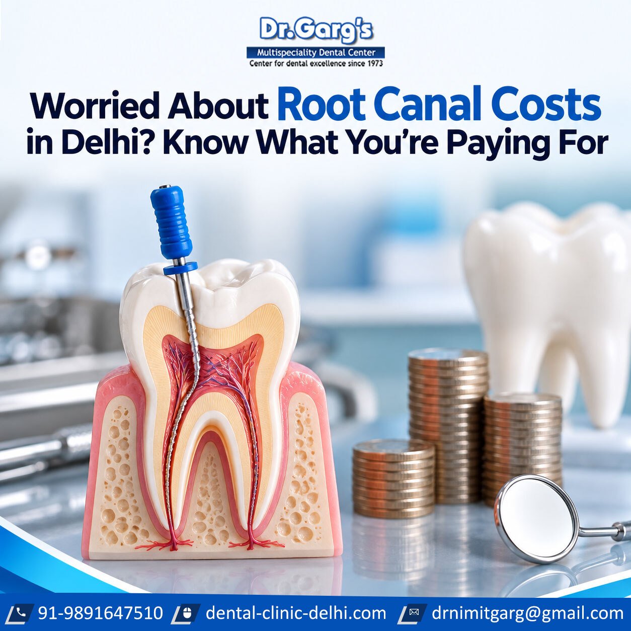 Worried About Root Canal Costs in Delhi? Know What You’re Paying For Worried About Root Canal Costs in Delhi Know What Youre Paying For - Worried About Root Canal Costs in Delhi? Know What You’re Paying For